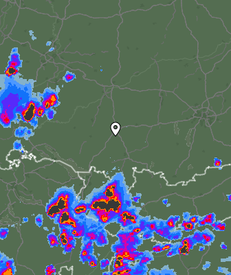 Radar