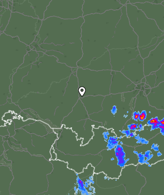 Radar