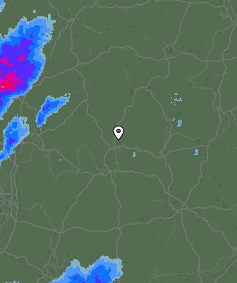 Radar