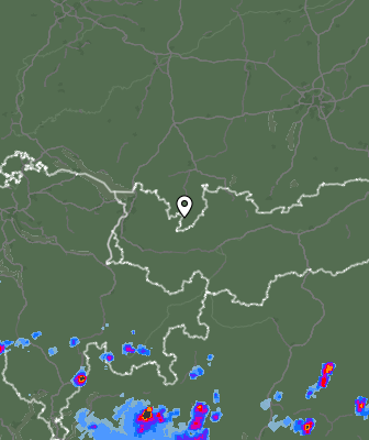 Radar