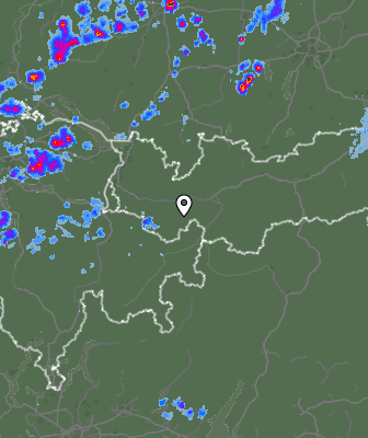 Radar