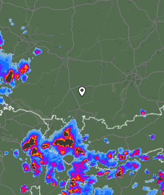 Radar