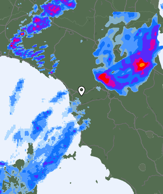 Radar