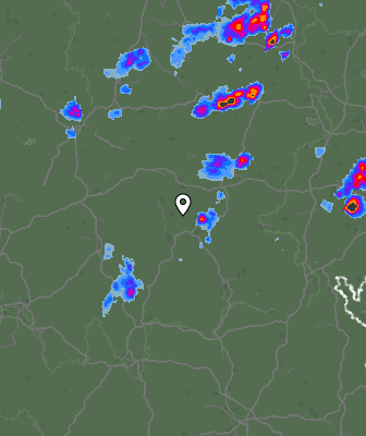 Radar
