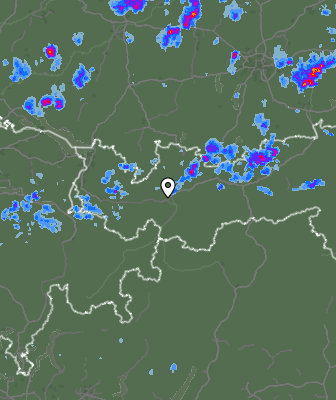 Radar