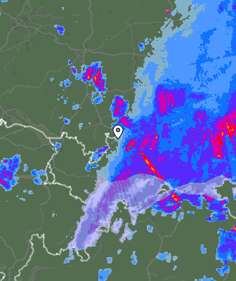 Radar