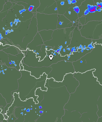 Radar