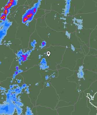 Radar