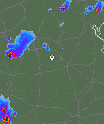 Radar
