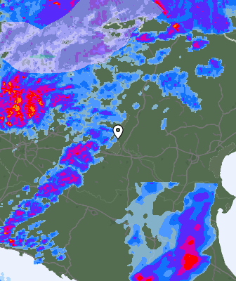 Radar