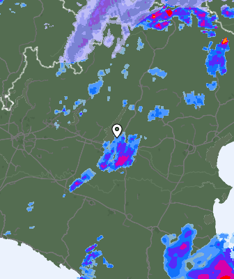 Radar