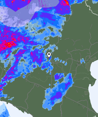 Radar
