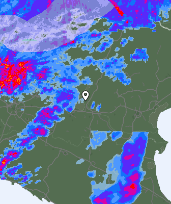 Radar