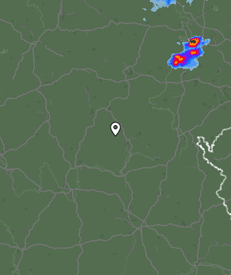 Radar