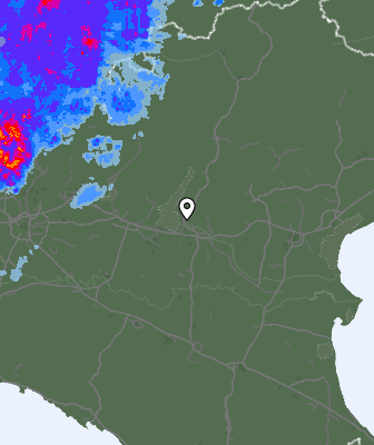Radar