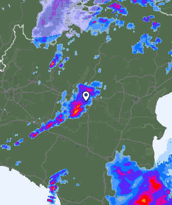 Radar