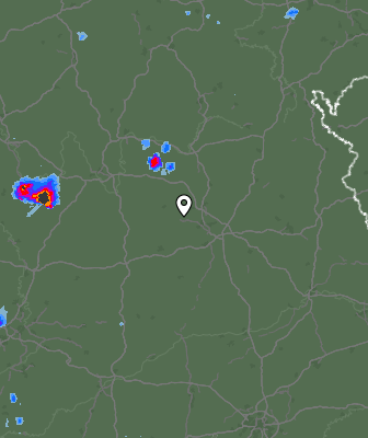 Radar