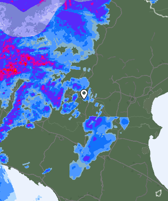 Radar