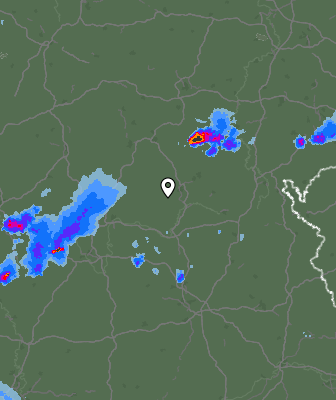 Radar
