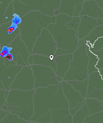 Radar