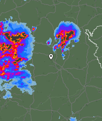 Radar