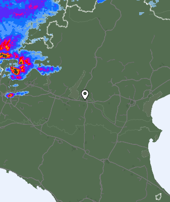 Radar