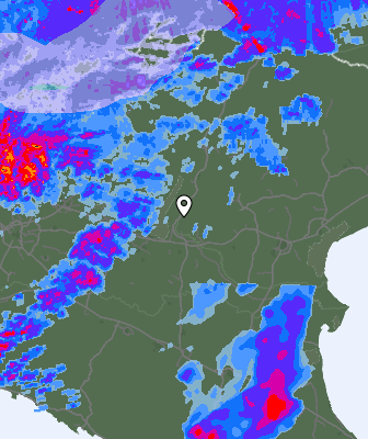 Radar