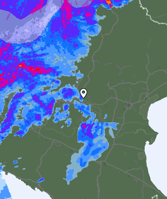 Radar