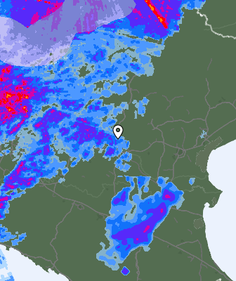 Radar