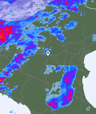 Radar