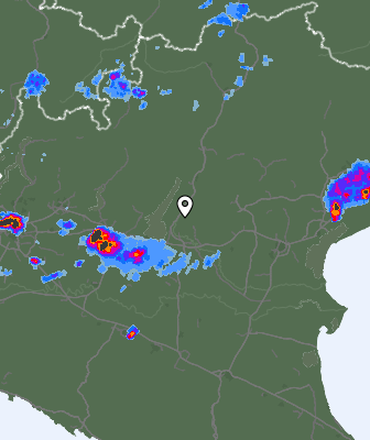 Radar