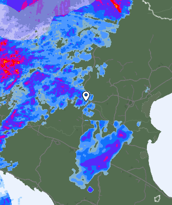 Radar