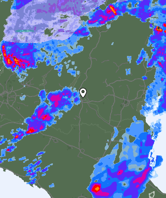 Radar