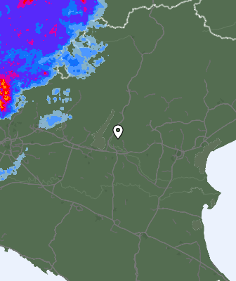 Radar