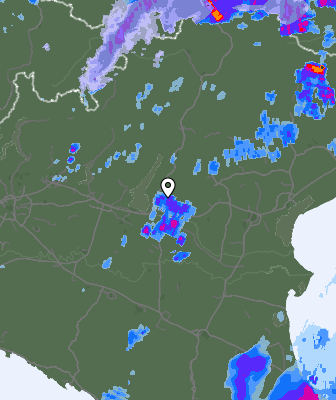 Radar