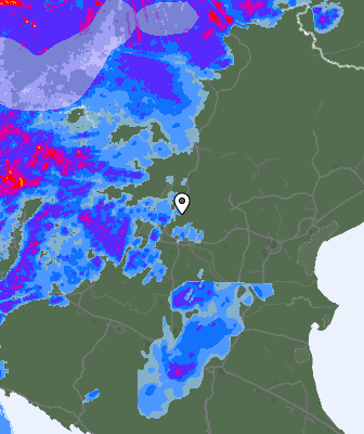 Radar