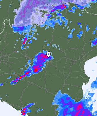 Radar