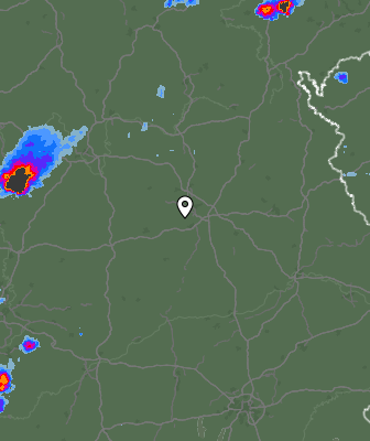 Radar