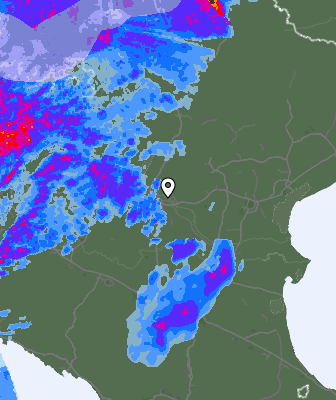 Radar