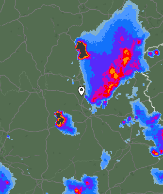Radar