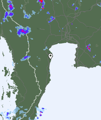 Radar