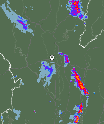 Radar