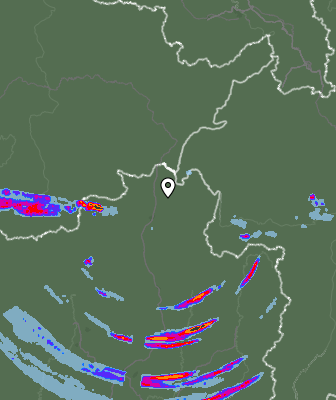 Radar