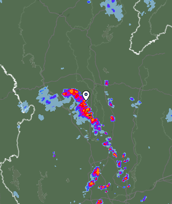 Radar