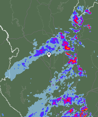Radar
