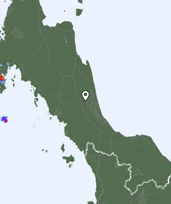 Radar