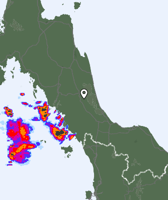 Radar