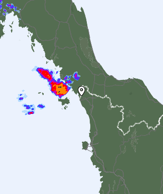 Radar