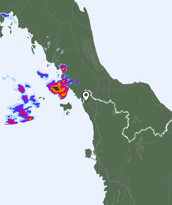 Radar