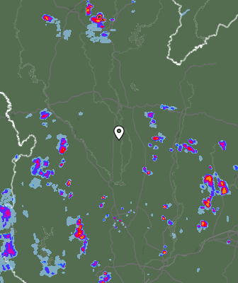 Radar